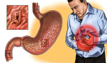 Read more for Ayurvedic Treatment of Anaemia Disease
