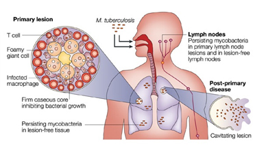 Read more for Ayurvedic Treatment of Anaemia Disease