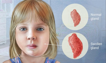 Read more for Ayurvedic Treatment of Anaemia Disease