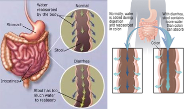 Read more for Ayurvedic Treatment of Anaemia Disease