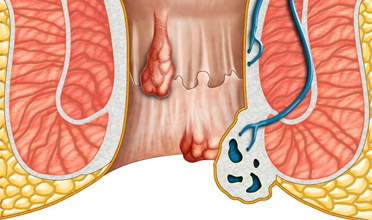Read more for Ayurvedic Treatment of Anaemia Disease