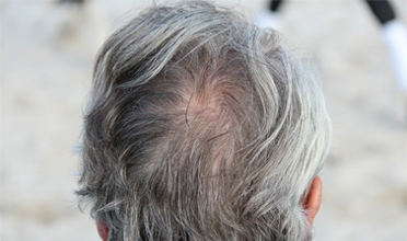 Read more for Ayurvedic Treatment of Anaemia Disease