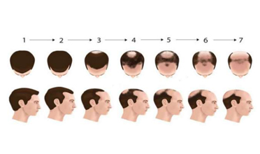 Read more for Ayurvedic Treatment of Anaemia Disease