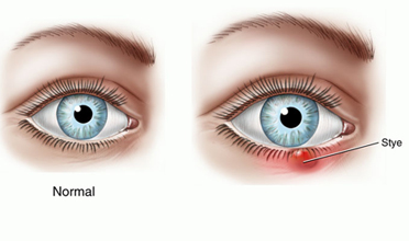 Read more for Ayurvedic Treatment of Anaemia Disease